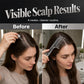 ✨💆♀️ Scalp Applicator Comb – Precision Flow, Gentle Tips, Clear Body! 🧴💧